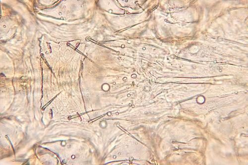 Ornithonyssus sp.
